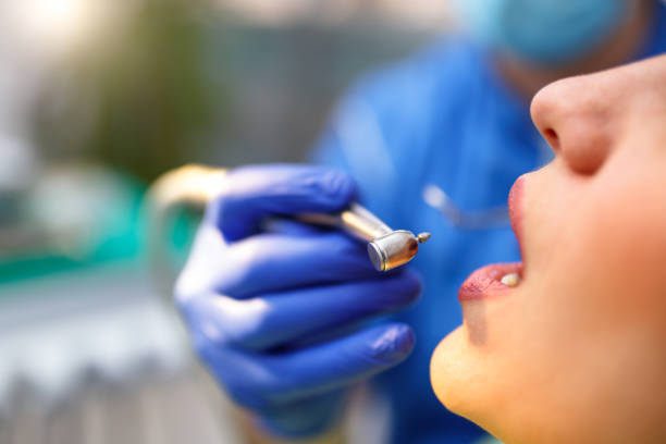 Dental Bonding in Millington, NJ